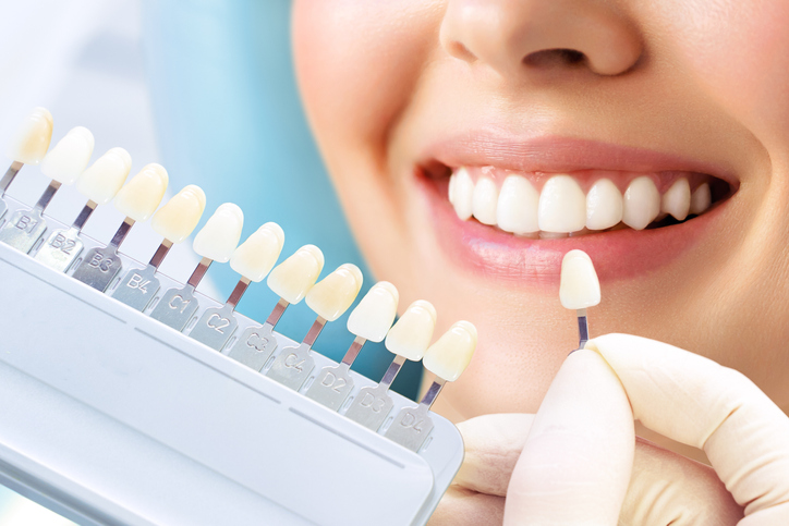 Smiling young woman. Cosmetological teeth whitening in a dental clinic. selection of the tone of the implant tooth